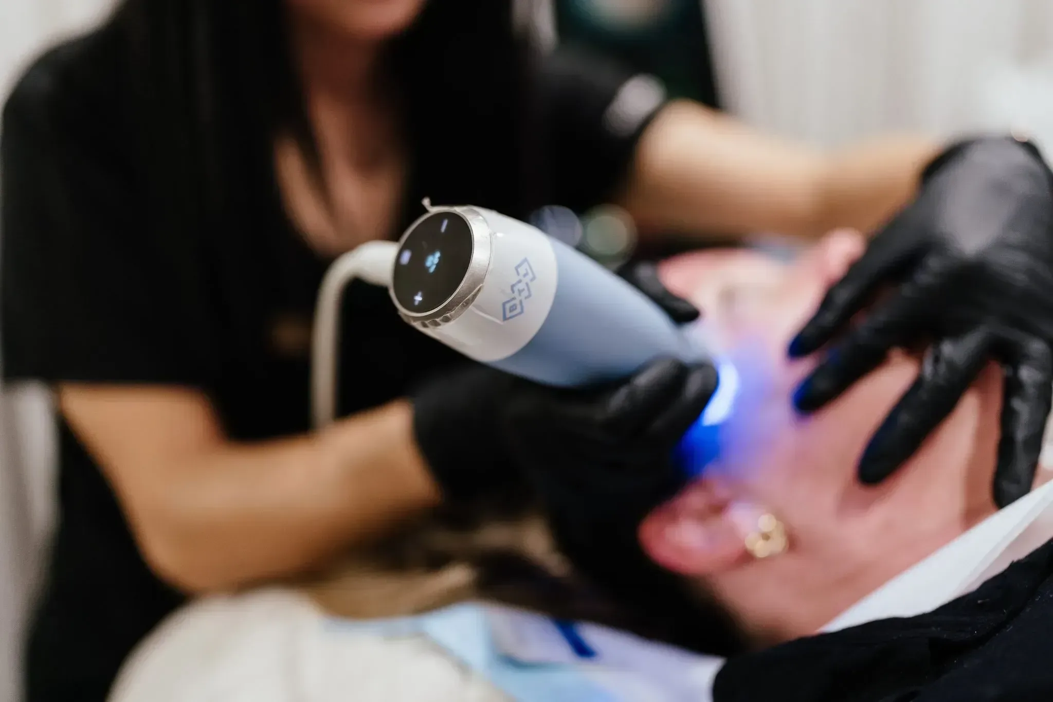 Patient receiving RF microneedling with the Exion applicator at Applegate Dentistry and MedSpa in Covington, KY